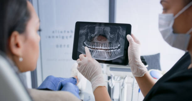 Licensed Tooth Extraction service in Larkspur, CA - Smile Center Dentistry